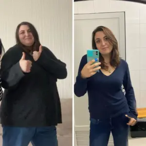 obezite cerrahisi deegisim sanati10