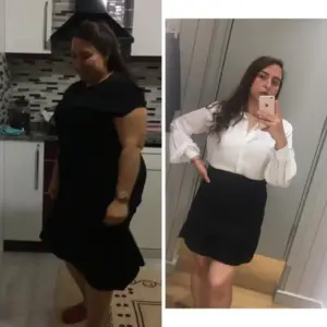 obezite cerrahisi deegisim sanati13