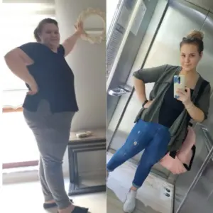 obezite cerrahisi deegisim sanati14