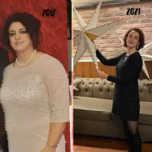 obezite cerrahisi deegisim sanati22