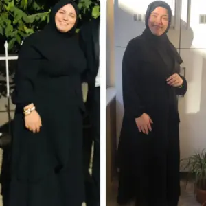 obezite cerrahisi deegisim sanati23