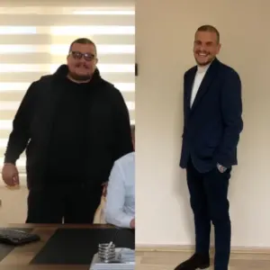 obezite cerrahisi deegisim sanati6