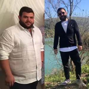 obezite cerrahisi deegisim sanati7