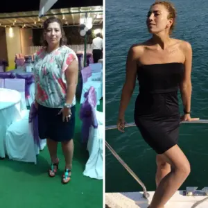 obezite cerrahisi deegisim sanati8